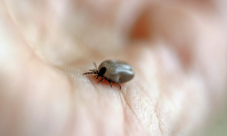 Co robić, gdy zobaczysz na sobie lub bliskim kleszcza?