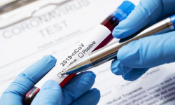 Kolejny przypadek zakażenia koronawirusem na terenie powiatu ząbkowickiego - 24.04, godz. 9.15