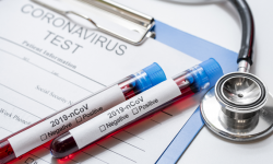 Informacje z terenu powiatu ząbkowickiego dotyczące koronawirusa - 8.05, godz. 9.30