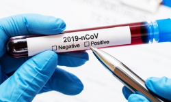 Pięć nowych przypadków zakażeń koronawirusem. Informacje z powiatu ząbkowickiego - 7.06, godz. 9