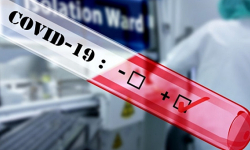 Sześć nowych przypadków zakażeń koronawirusem w powiecie ząbkowickim - 18.07, godz. 10