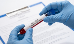 7 nowych zarażeń i 4 ozdrowieńców. Informacje z terenu powiatu dot. koronawirusa - 31.08, godz. 10