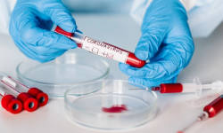 78 nowych przypadków w ciągu weekendu. Nie żyje 6 osoba - informacje dot. koronawirusa - 2.11, g. 11