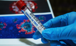 29 nowych zakażonych i 14 kolejnych ozdrowieńców. Informacje dot. koronawirusa - 6.11, godz. 16