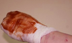 Piłeś alkohol – nie odpalaj petard