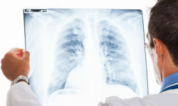 Sprawdź kondycję swoich płuc. Badania spirometryczne w Kamieńcu Ząbkowickim