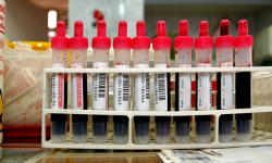 U strażaka-ochotnika z Budzowa zdiagnozowano sepsę. Potrzebna krew