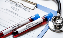 Dyrektor sanepidu o sytuacji epidemiologicznej w powiecie i spodziewanej drugiej fali zachorowań