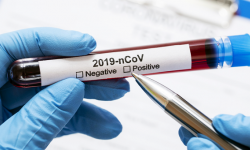 Kolejna osoba zakażona koronawirusem w powiecie ząbkowickim. Aktualne dane - 28.08, godz. 9