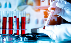 101 zakażeń  koronawirusem w powiecie od początku epidemii. Aktualne dane - 9.10, godz. 10