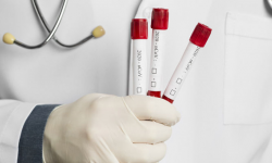 Wzrosła liczba osób na kwarantannie. Informacje z powiatu dot. koronawirusa - 13.10, godz. 9.30