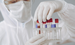 Koronawirus: 88 nowych przypadków i 148 ozdrowieńców w trakcie weekendu. Nie żyje 17 osoba - 23.11